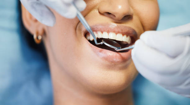 Best Emergency Dental Extractions in Black Hammock, FL