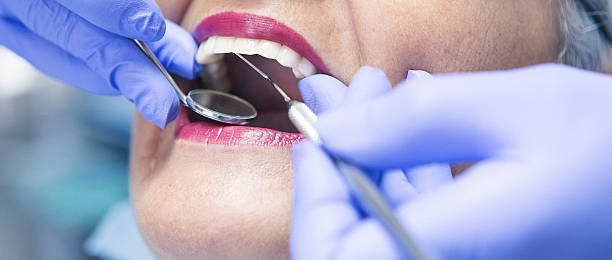 Best Broken or Cracked Tooth Emergency Dentist in Black Hammock, FL